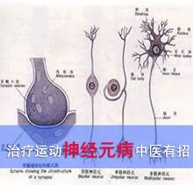 运动神经元病治疗_神经病治疗运动元素是什么_运动神经元病锻炼