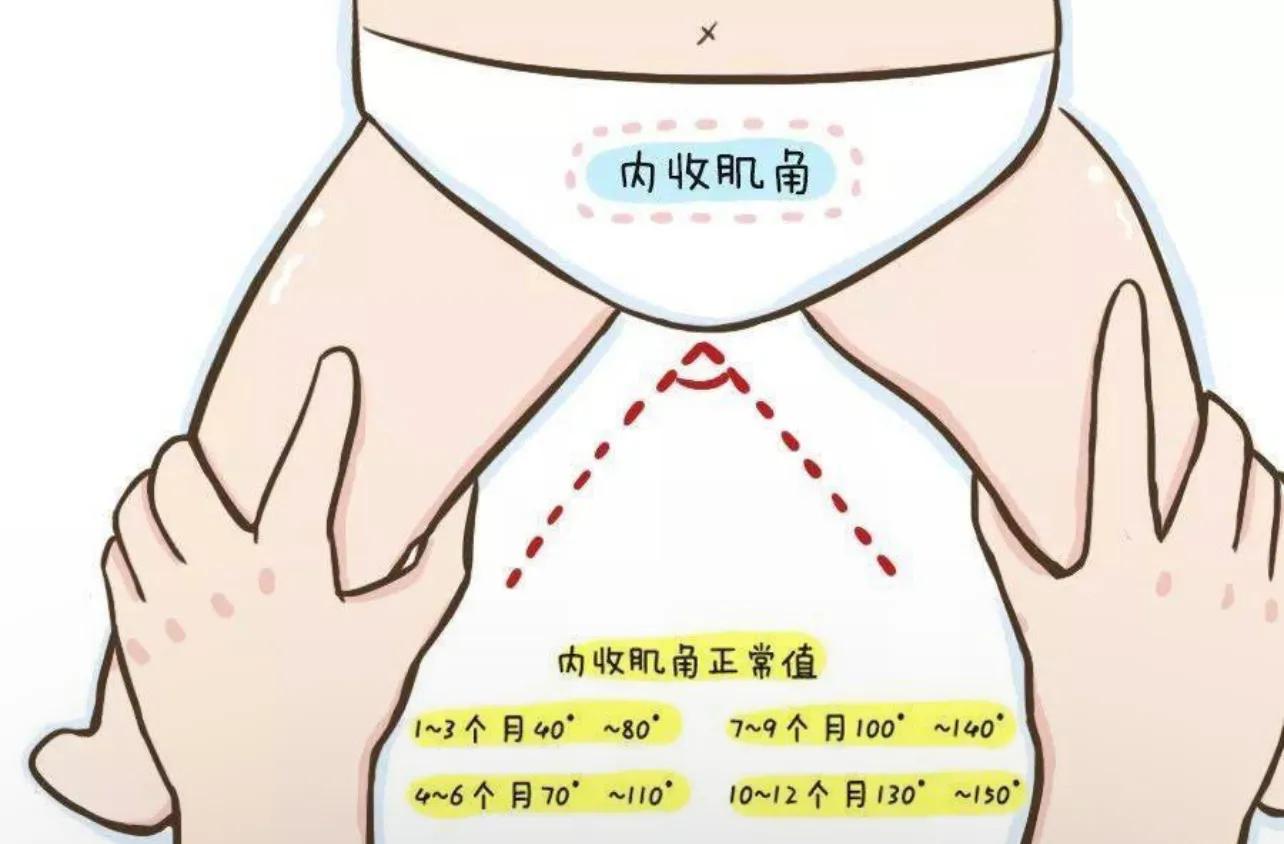 肌张力运动性差怎么办_运动性肌张力_肌张力运动性障碍能运动吗